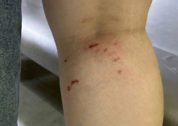 В Ставропольском крае и Омской области собаки напали на детей, СК возбудил уголовные дела — Экологические новости на ECOportal.su